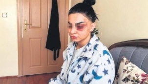 26 yaşındaki hemşire kabusu anlattı: Ben sustum siz susmayın