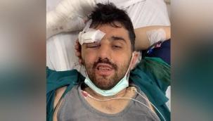 Madendeki göçükte yaralanan işçi tedaviye alındı