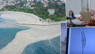 Sebebi ortaya çıktı.. Müsilaj kâbusunun ilk test sonuçları belli oldu! Deniz salyasının nedeni tek hücreli canlı...