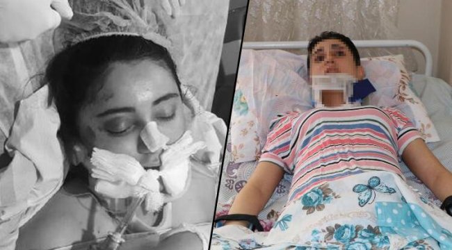 Eşinin balkondan atıp, 'intihara kalkıştı' dediği Çiğdem: Felç kaldım, adalet istiyorum