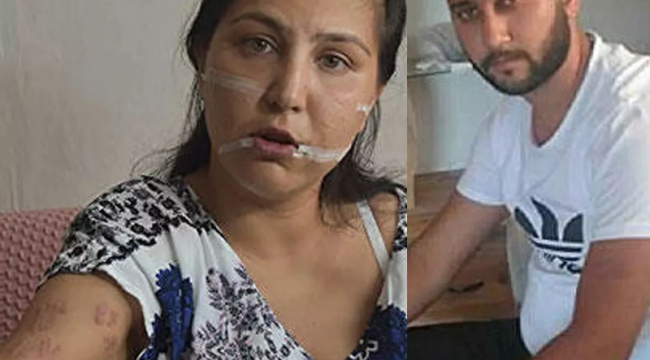 Eşini 104 yerinden bıçaklamıştı: Kaç yıl hapsi isteniyor?