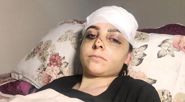 Tayt dayağı: Karısını öldüresiye döven cani serbest kaldı