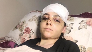 Tayt dayağı: Karısını öldüresiye döven cani serbest kaldı