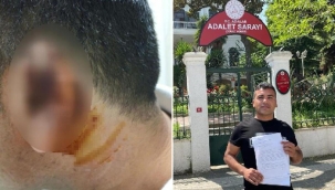 İnanılmaz olay! Kavgada ısırılarak koparılan kulağını martı kaptı